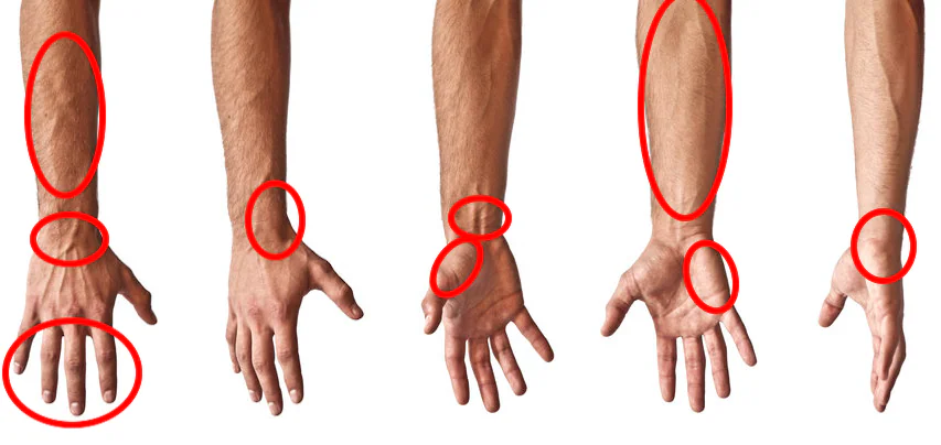 Wrist Pain Cheat Sheets