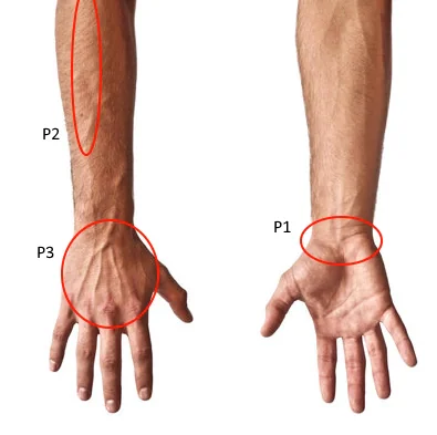 Amy's pain regions — right wrist, hand, and elbow