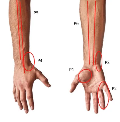 Julian's bilateral pain regions across wrist, hand and forearm