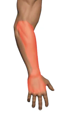 Back Side Wrist Pain — Fox Fingers · EDC Tendinopathy