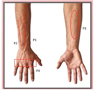 Pain to Recovery: A Desk Worker's Journey — 8-Week Wrist Pain Case Study