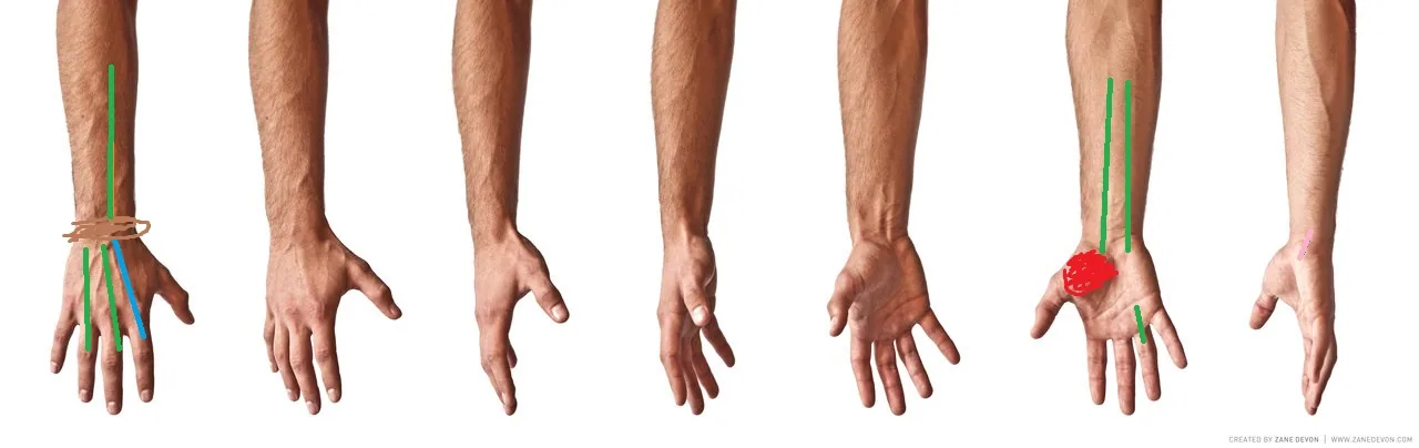 Common Pain Patterns through my experience within eSports 