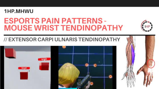 Mouse Wrist Tendinopathy  - #3 Wrist Pain with Gaming