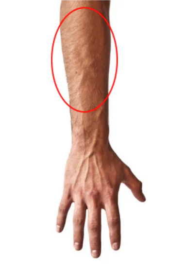 Forearm Pain From Gaming