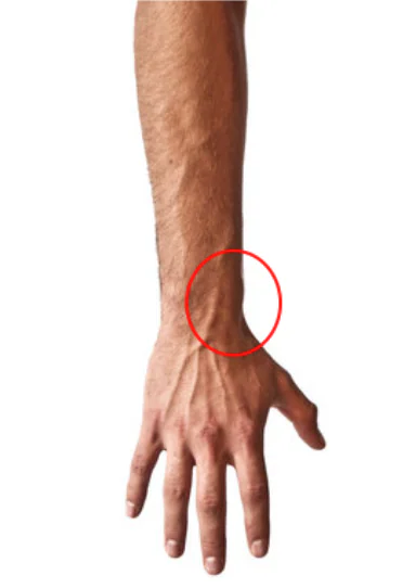 Thumb Side Wrist Pain From Gaming