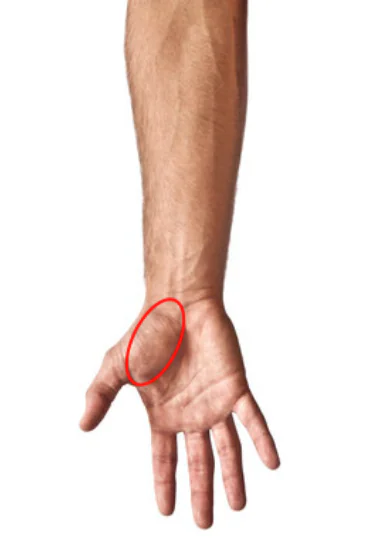 Thumb Pain From Gaming