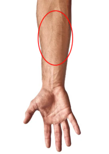 Forearm Pain From Gaming