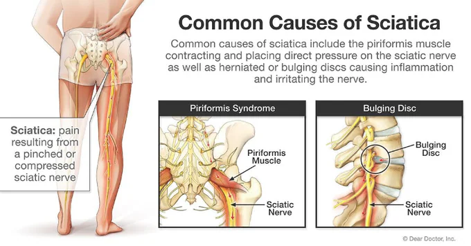 Gaming Injuries