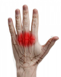 general ergonomic view