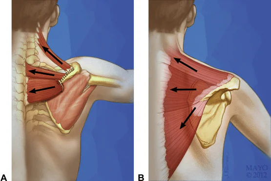 Parascapular Musculature Responsible For Keeping Shoulders Back