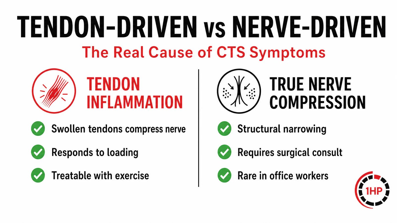 Carpal Tunnel Syndrome Key Symptoms: Numbness, grip weakness, night symptoms, and thenar atrophy
