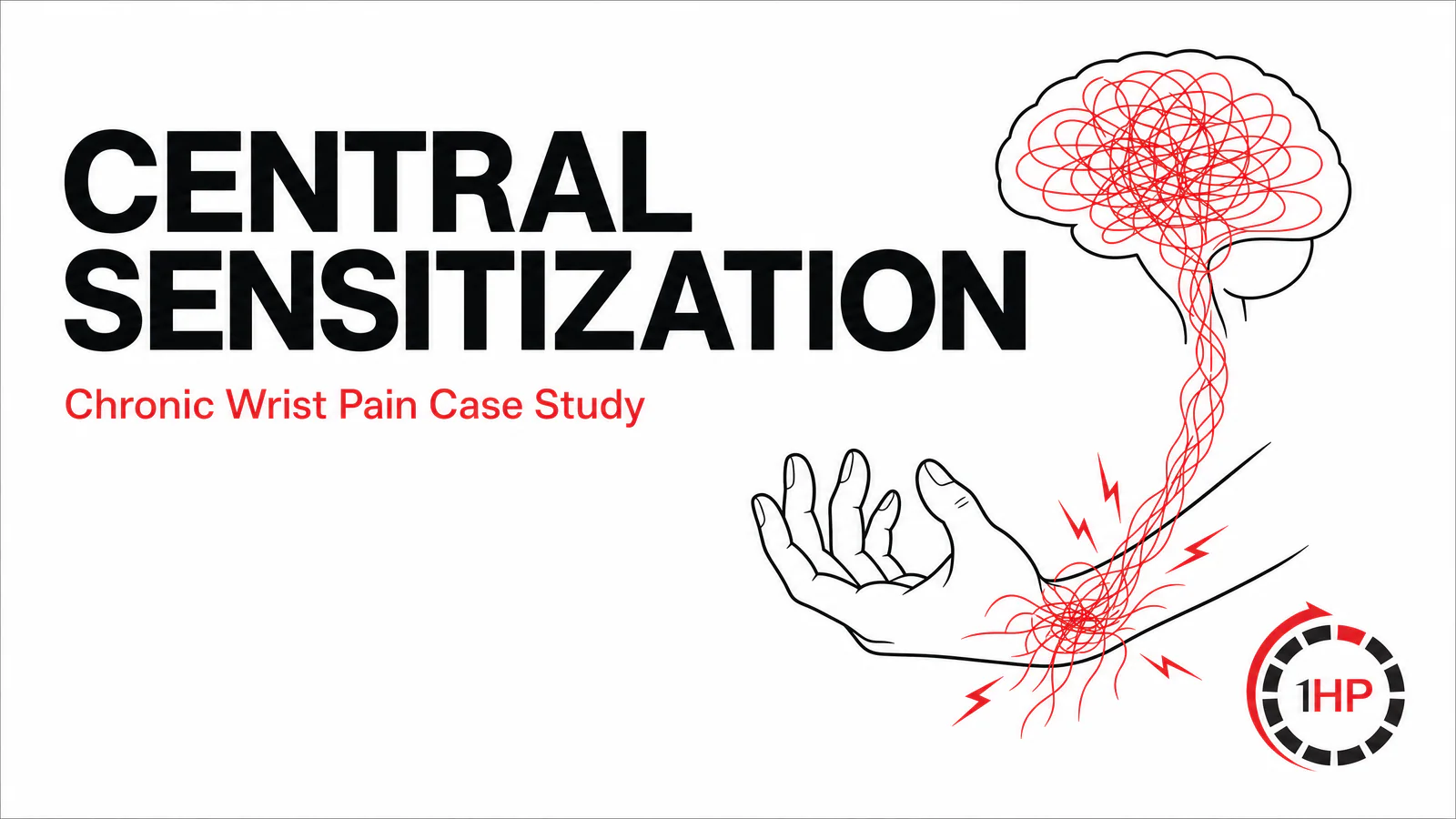 Beyond Tissue Damage: A Case Study on Chronic Wrist Pain & Central Sensitization in Gamers
