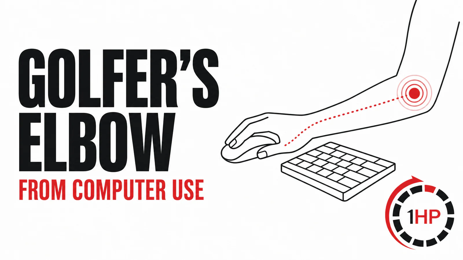 Computer-Related Golfer's Elbow