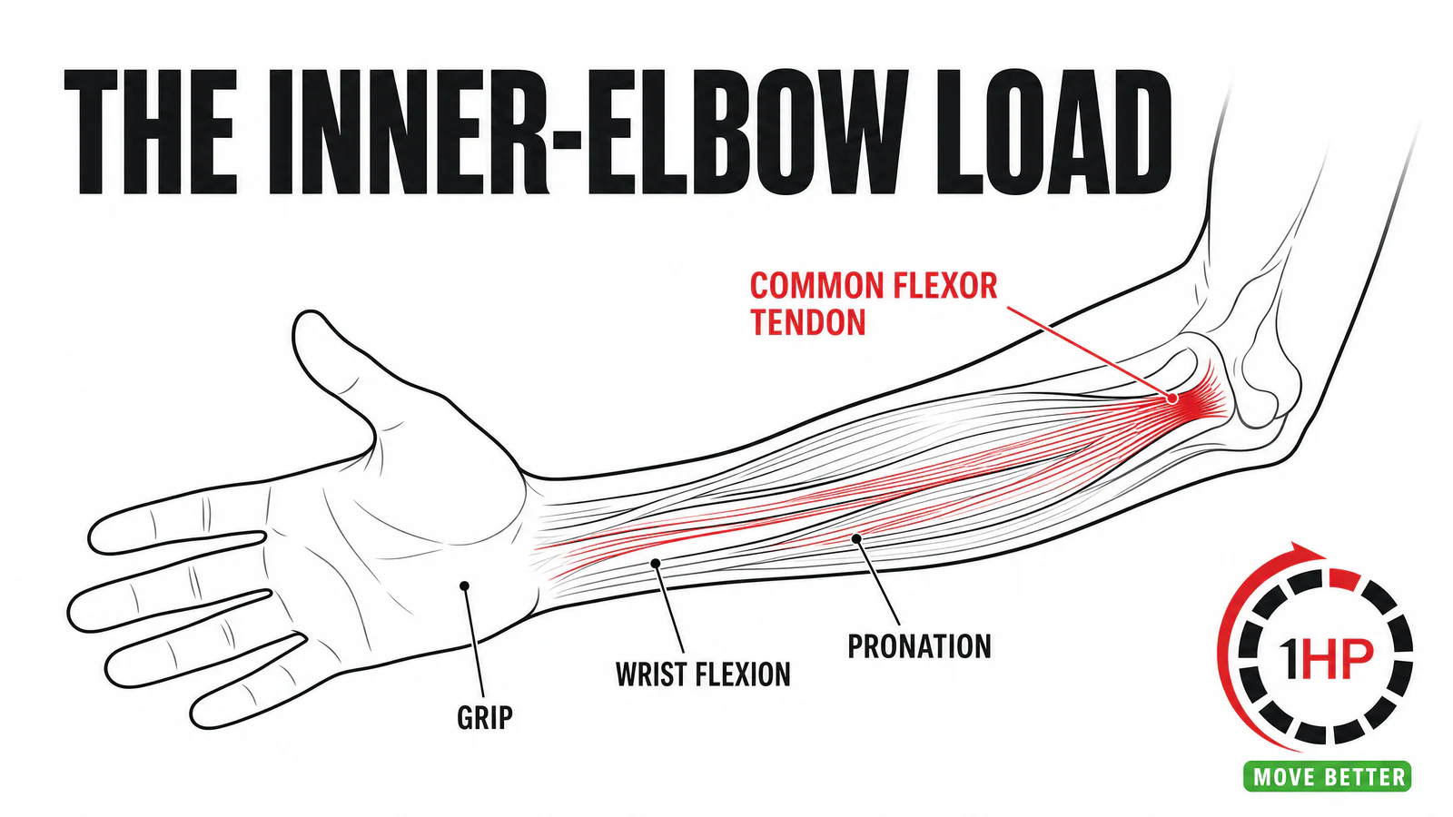 Computer-related golfer's elbow anatomy graphic showing the common flexor tendon and flexor-pronator muscles on the inside of the elbow