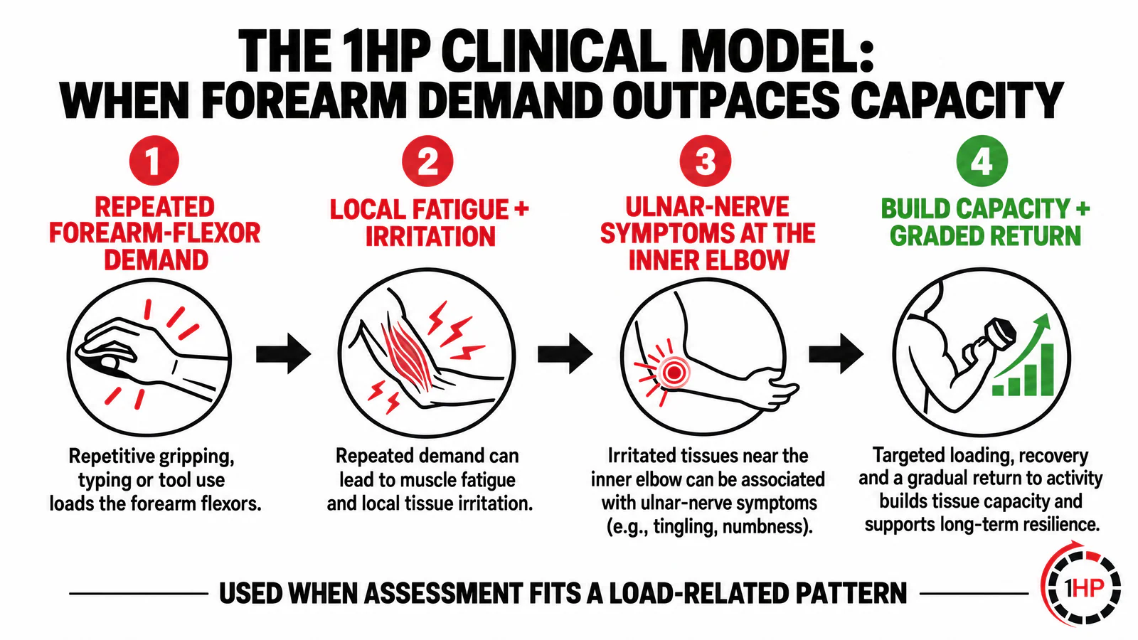 Cubital tunnel syndrome 1HP clinical model graphic showing repeated forearm-flexor demand, local fatigue, ulnar-nerve irritation, and capacity-first recovery.