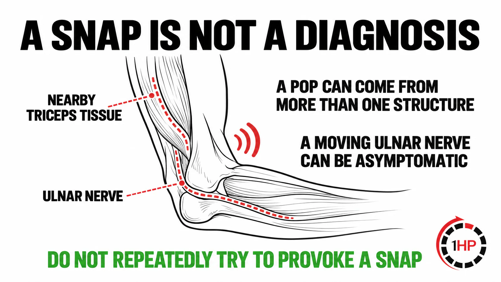 Cubital tunnel syndrome inner-elbow graphic showing that a pop can come from the ulnar nerve or nearby triceps tissue and is not a diagnosis.