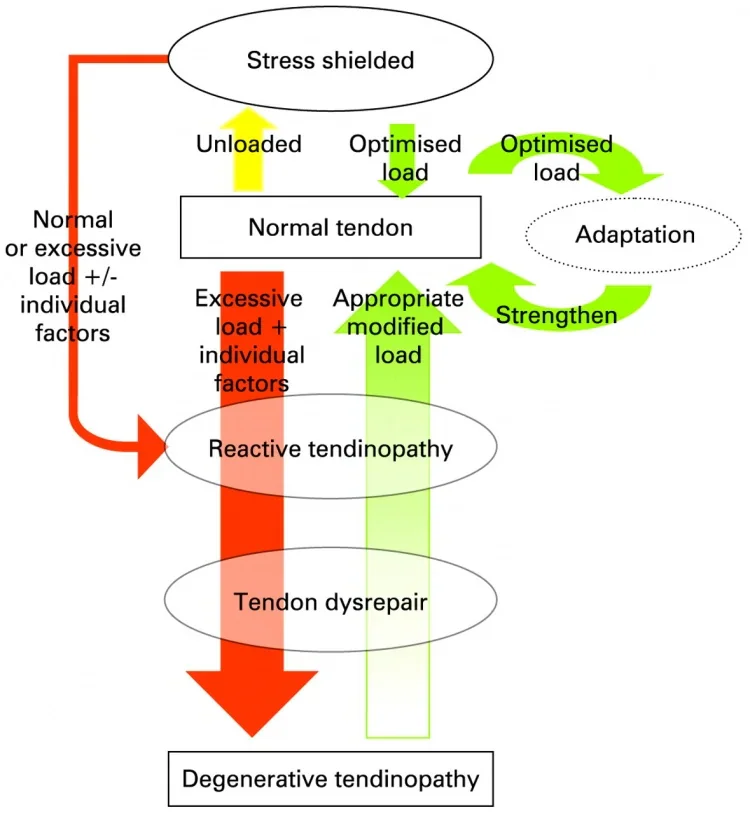 Dentist hand pain source graphic explaining a load-related tendon concept