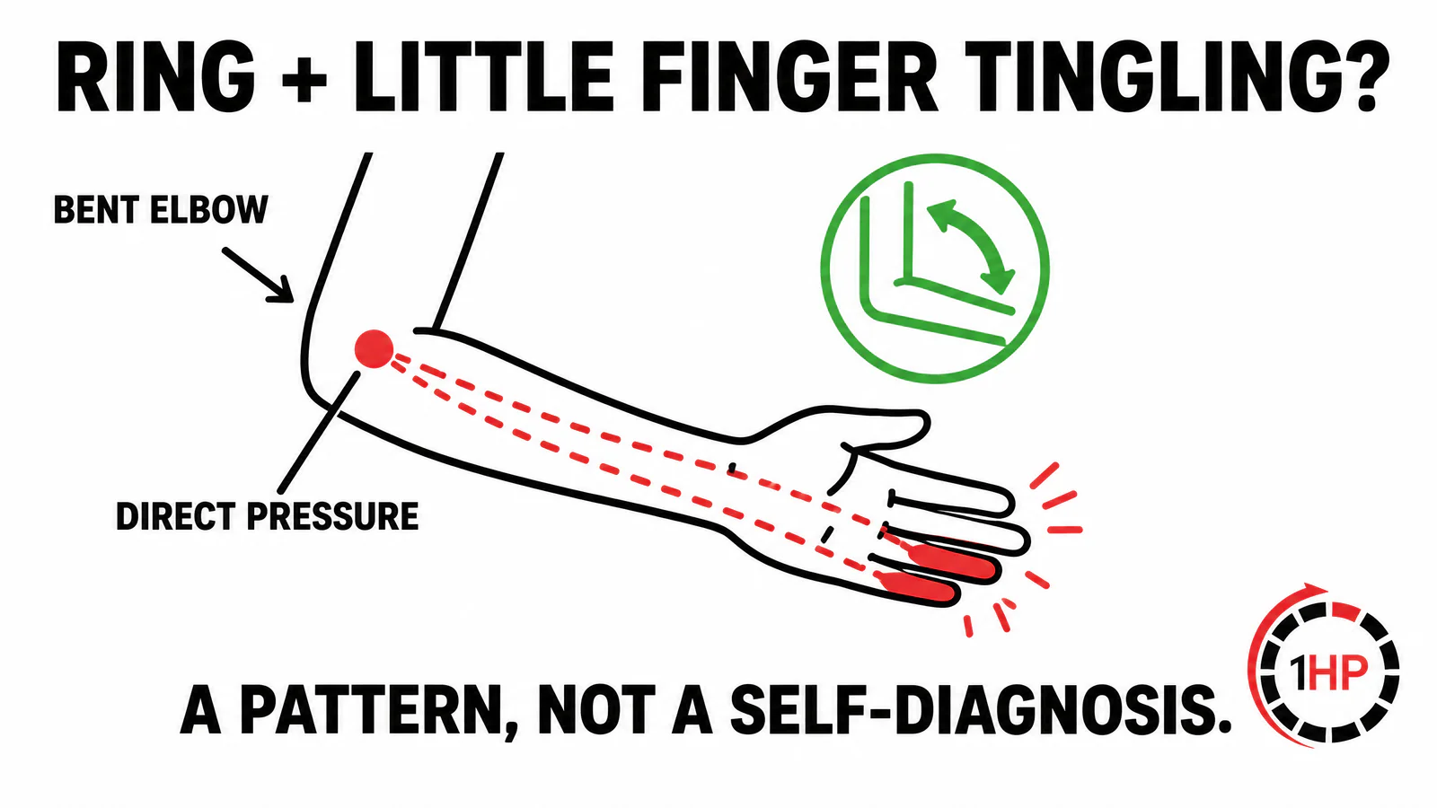 Esthetician wrist pain ulnar nerve pattern graphic showing ring and little finger tingling with elbow flexion and pressure