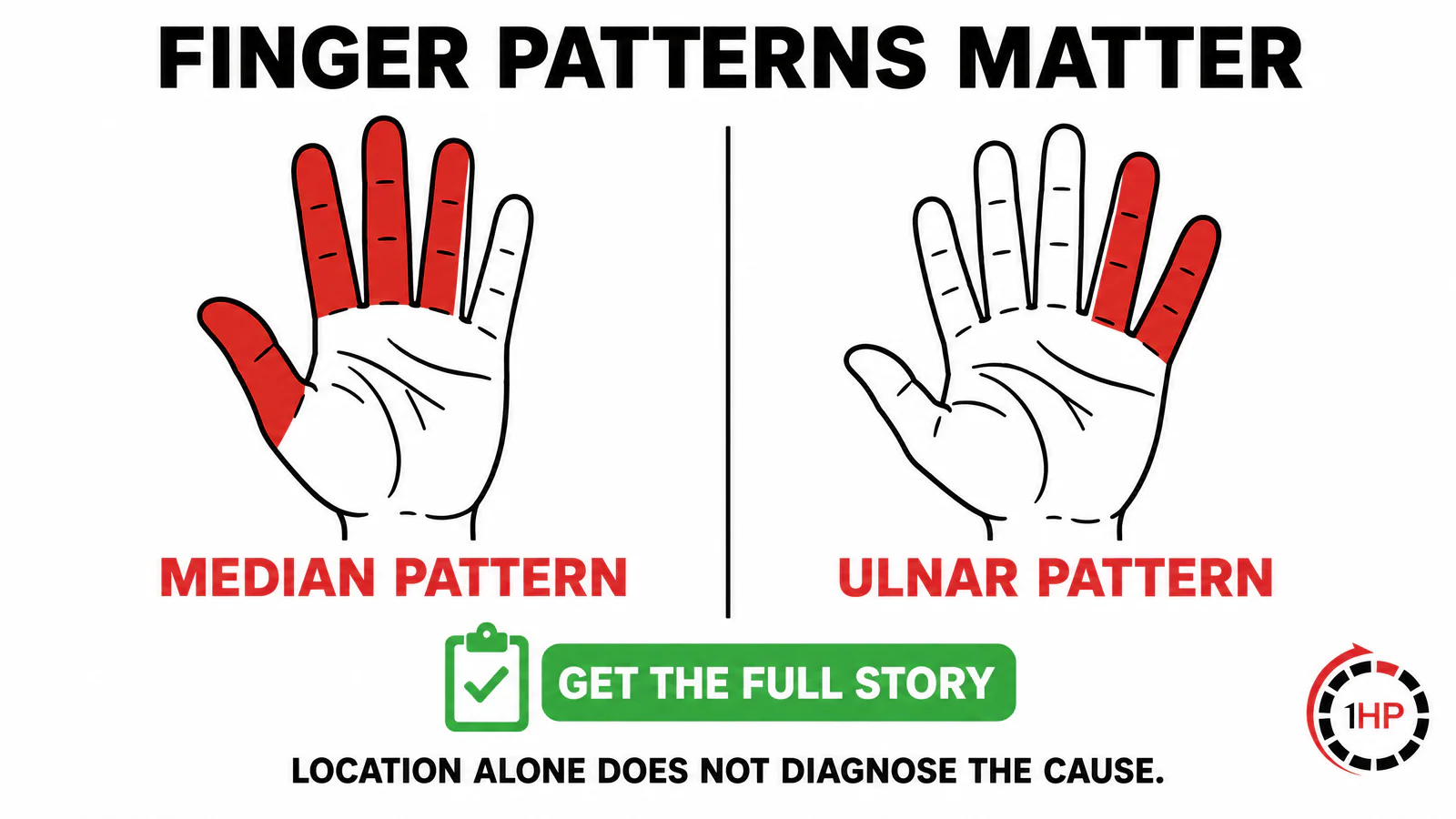 Esthetician wrist pain finger-pattern comparison showing median nerve carpal tunnel symptoms versus ulnar nerve symptoms