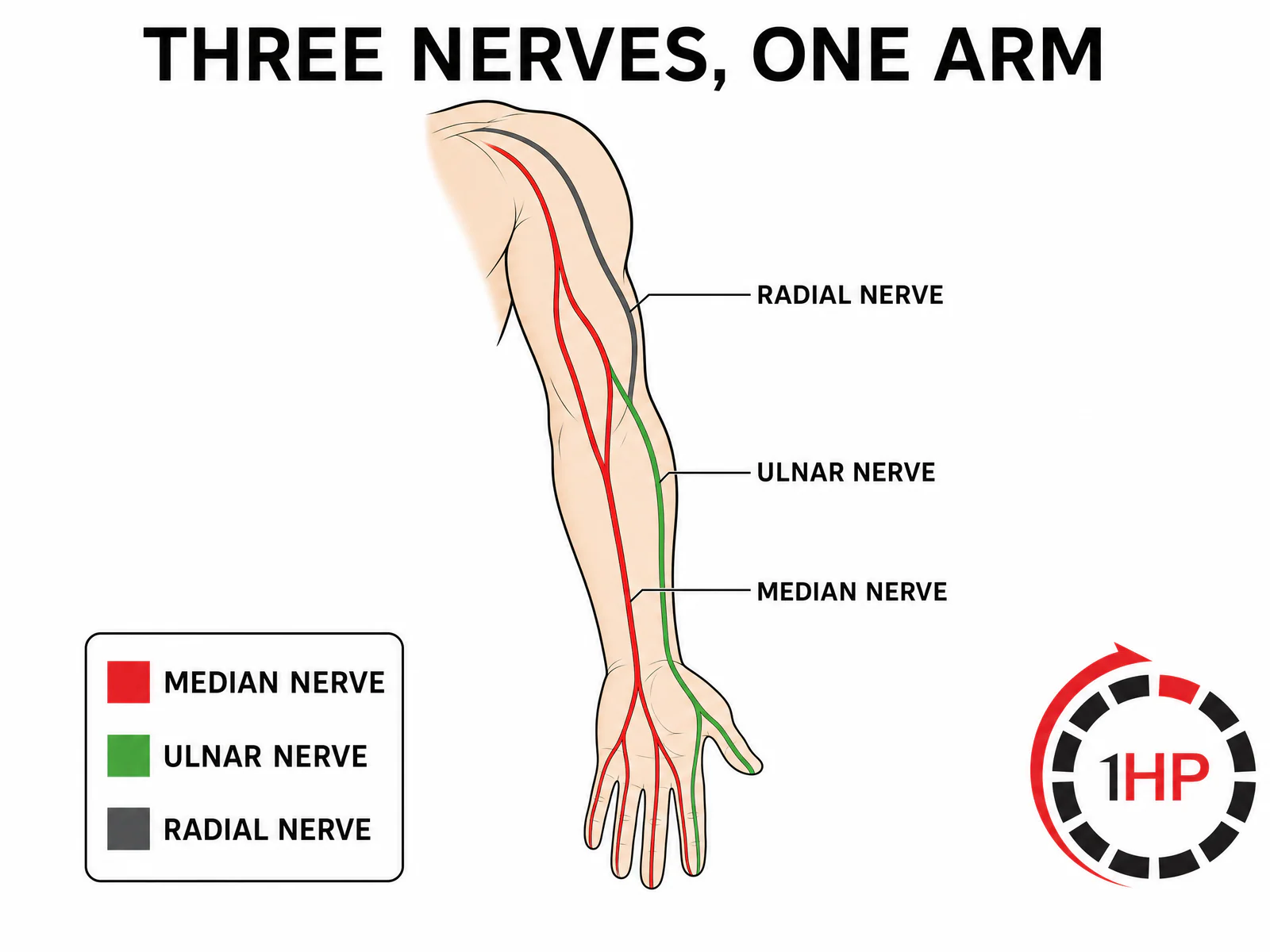 Anatomical map showing the median, ulnar, and radial nerve paths in the arm for nerve compression