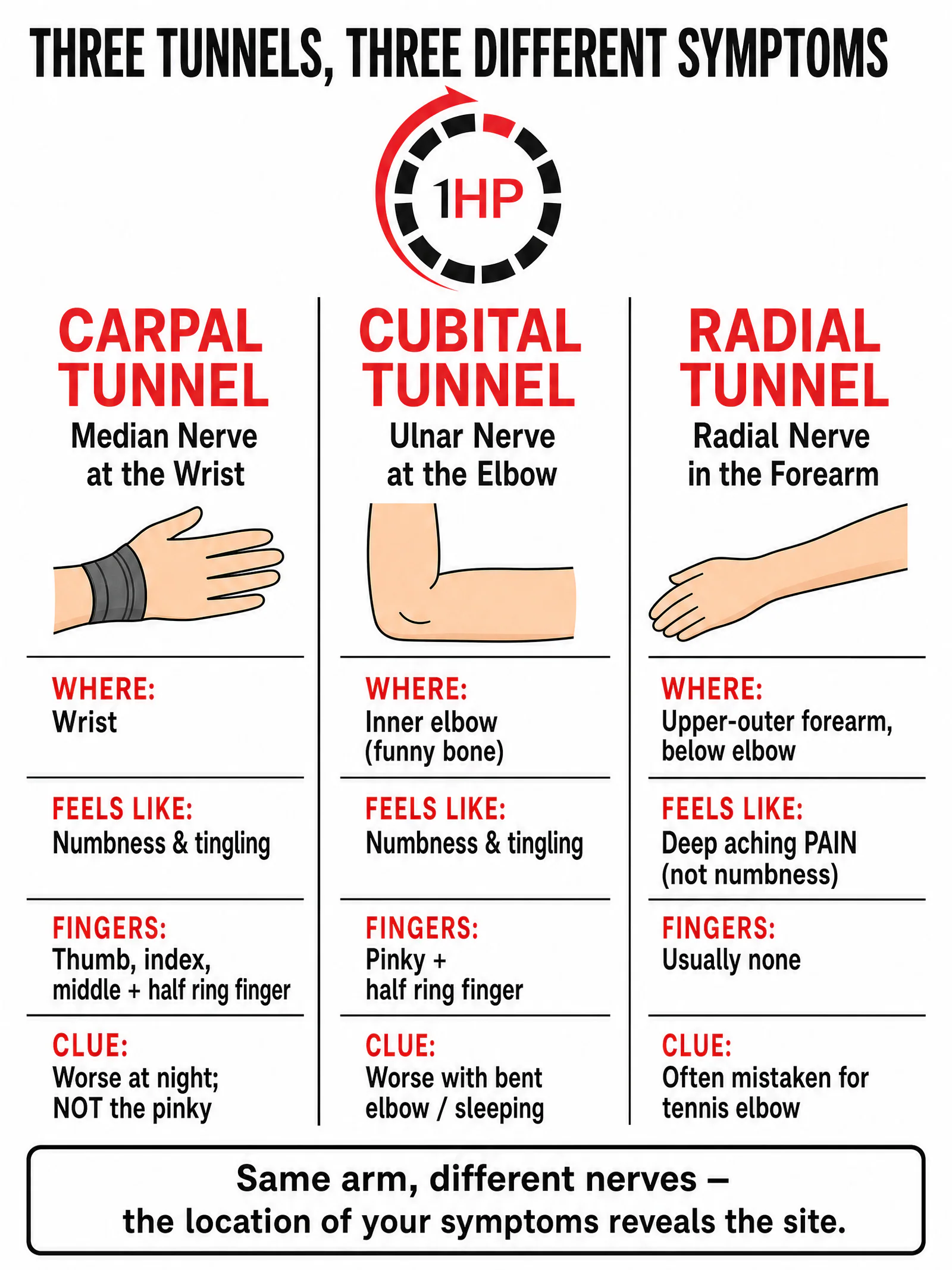 Comparison of carpal tunnel, cubital tunnel, and radial tunnel nerve compression in the arm symptoms