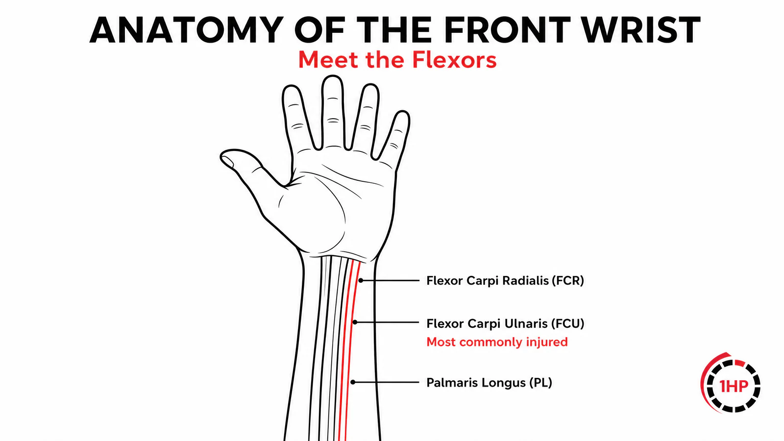 2 Self-Tests for Palm Sided Wrist Pain: Resisted finger flexion and passive extension stretch