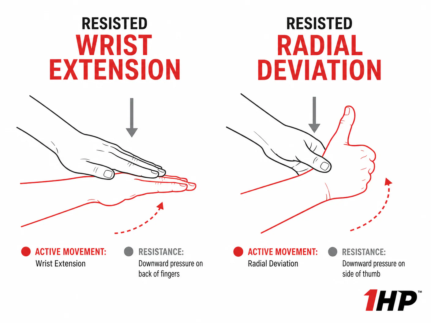Demonstration of isometric exercises for wrist extension and radial deviation
