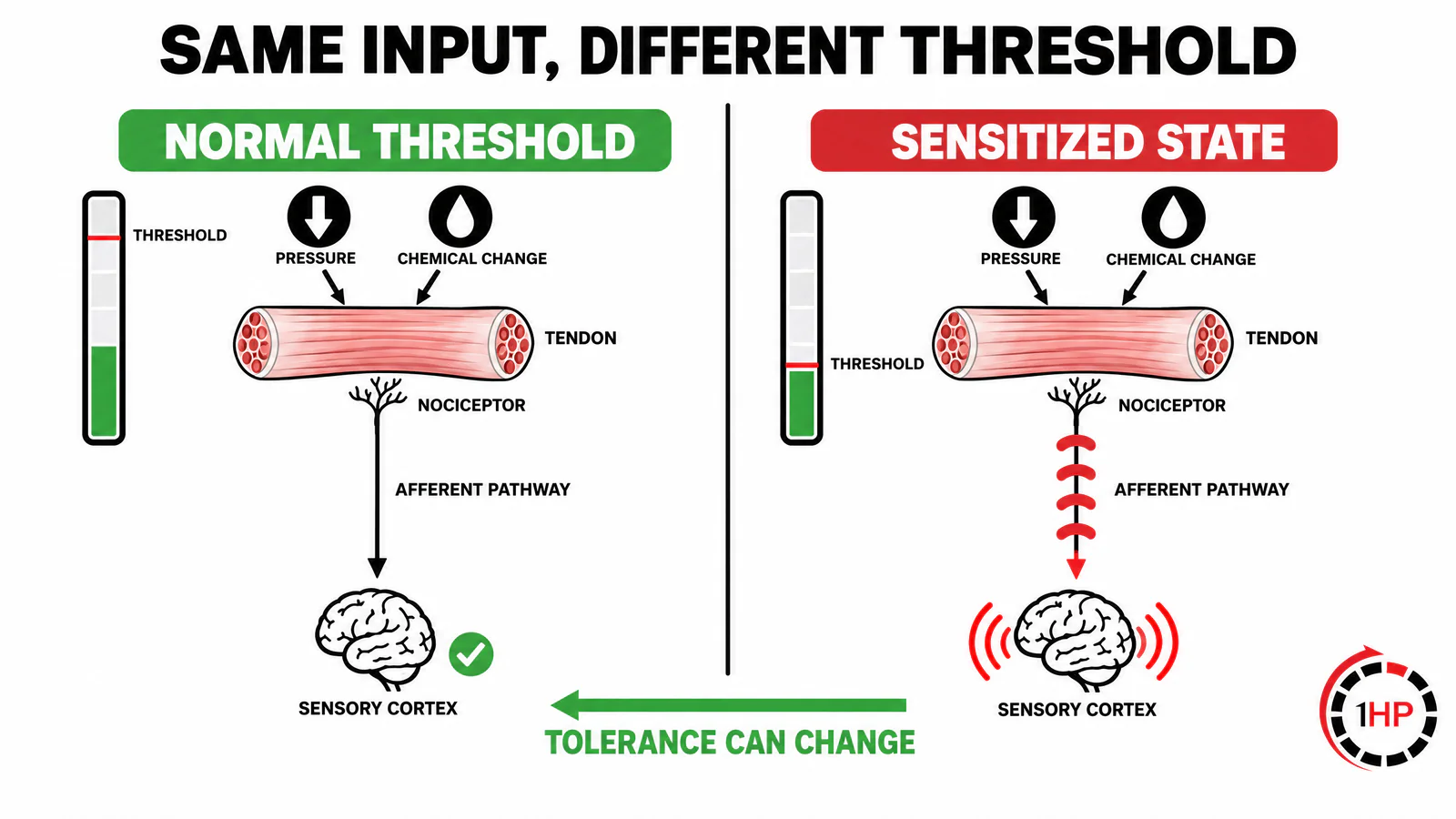 Sensitization and RSI pain nociceptor pathway graphic comparing pressure and chemical change inputs, afferent signaling, sensory cortex response, and a lower threshold