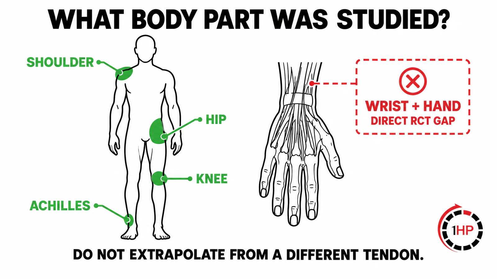 Stem cell therapy for tendonitis in wrist and hand body-region evidence map showing trials in shoulder Achilles hip and knee but a wrist hand gap