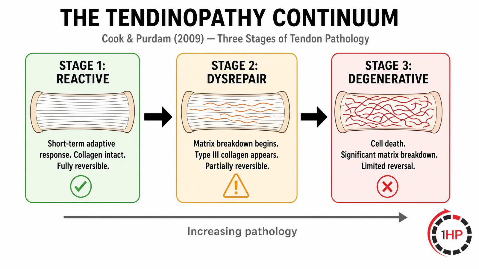 The three stages of the tendinopathy continuum from reactive to dysrepair to degenerative tendinopathy
