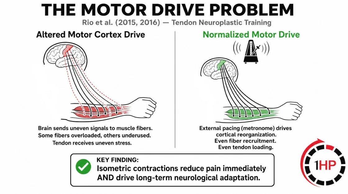Motor drive problem and tendon neuroplastic training showing how metronome-paced exercise normalizes brain signals in the tendinopathy continuum