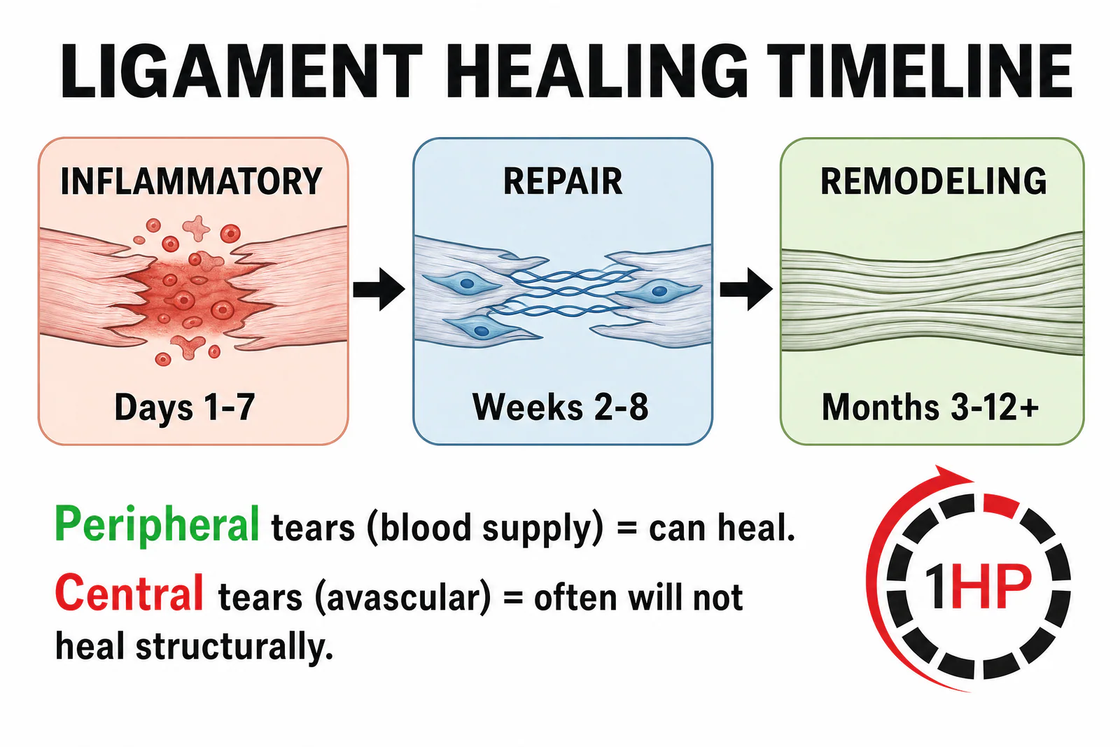 Ligament healing timeline for TFCC tear recovery