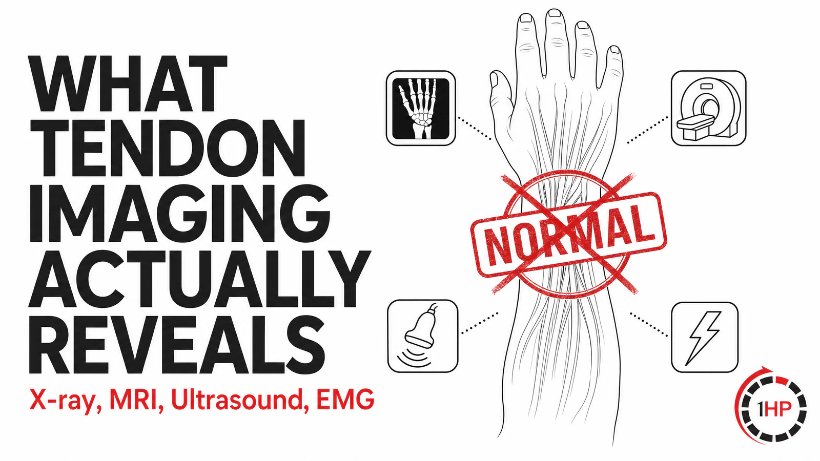 What Tendon Imaging Actually Reveals: X-ray, MRI, EMG