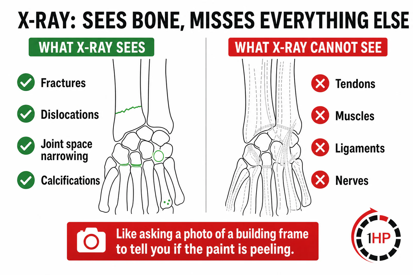 X-Ray Sees Bone Misses Everything Else infographic showing what it sees and cannot see