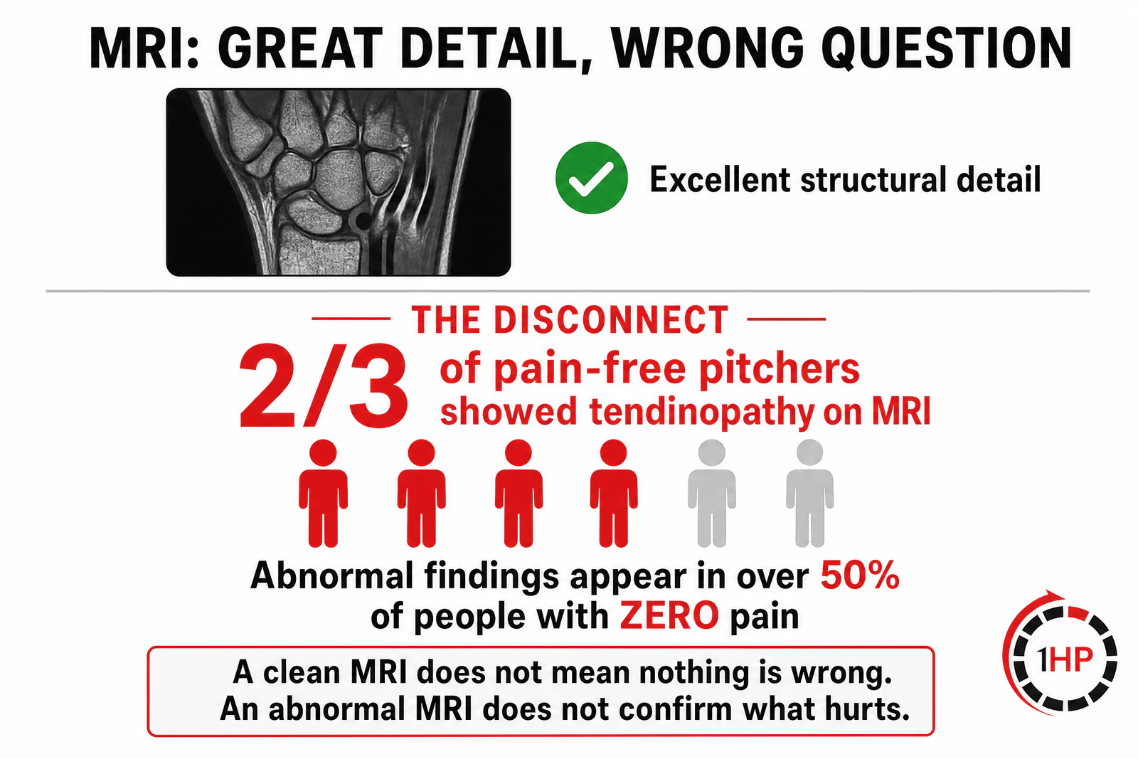 MRI Great Detail Wrong Question infographic showing disconnect between abnormal findings and pain