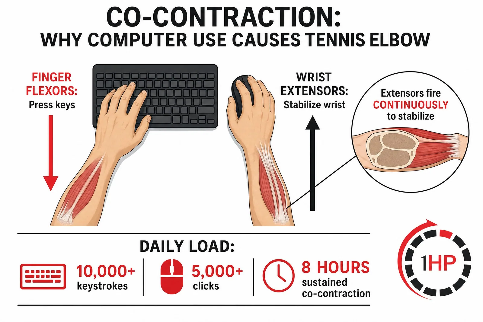 Co-contraction during computer use causing tennis elbow