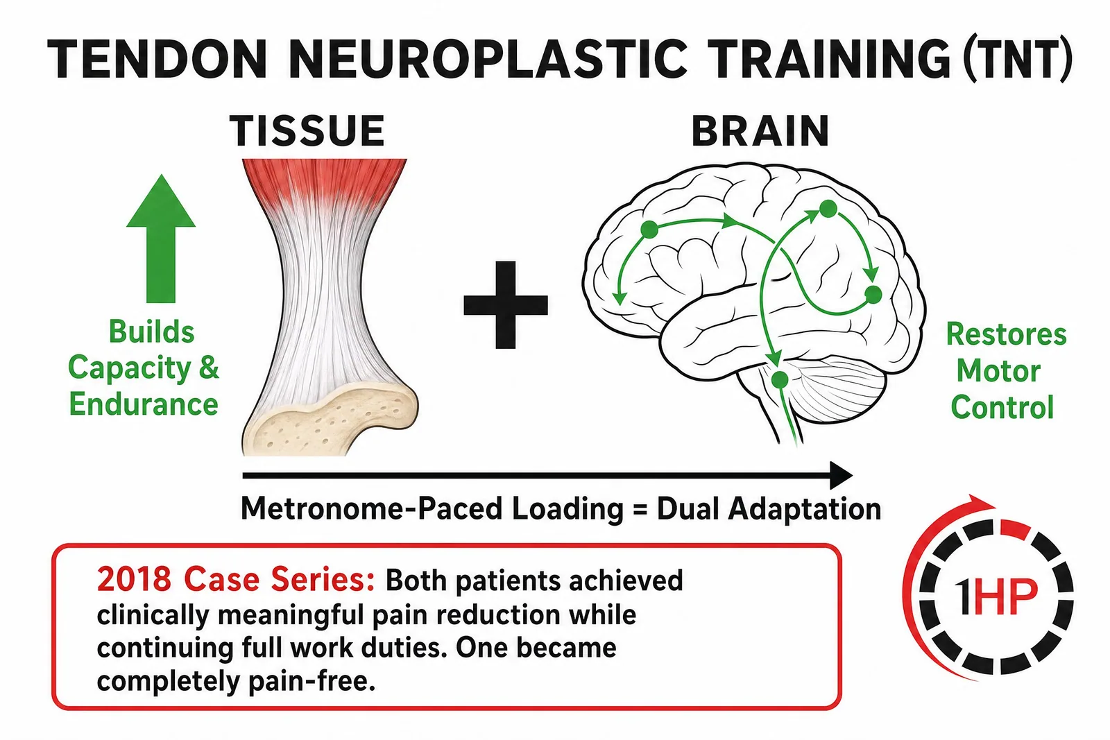 Tendon Neuroplastic Training (TNT) Concept