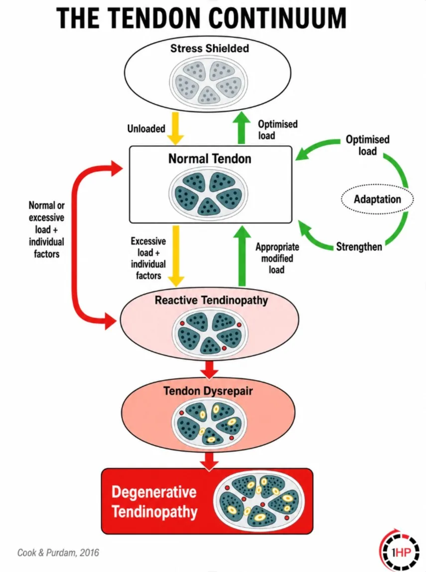 Cook and Purdam Tendinopathy Spectrum Disorders - The Tendon Continuum