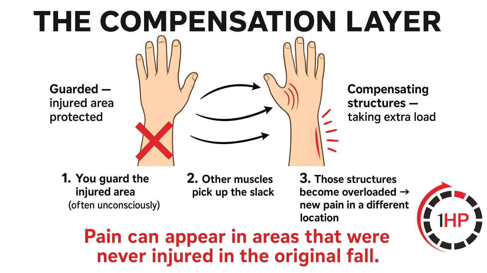 Wrist pain after injury healed: The compensation layer shifts load to uninjured structures